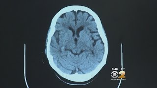 Dr. Max Gomez: Prostate Cancer