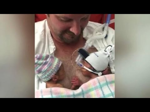 Video: Bayi Kembar Yang Baru Lahir Berpegangan Tangan (VIDEO)