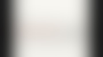 Robotic Radical Prostatectomy with Bilateral Pelvic Lymph Node Dissection