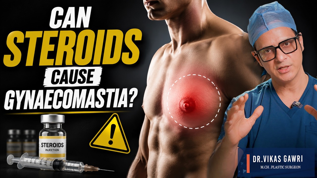 Can Steroids Cause Gynaecomastia? Ludhiana Punjab Expert