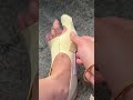Say Goodbye to Bunion Pain Forever! 🛑🦶