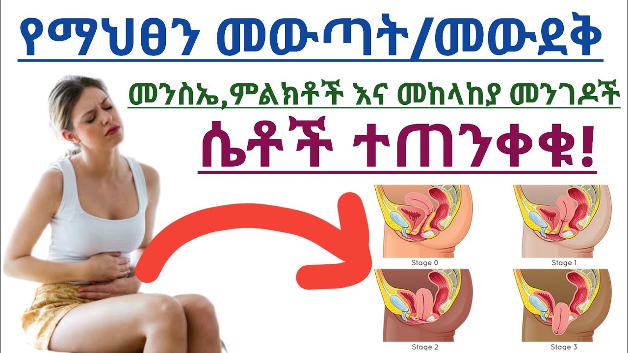 የማህፀን መውጣት/መውደቅ ምንነት,የሚከሰትበት መንስኤ,ምልክቶች እና መከላከያ መፍትሄዎች| Uterine prolapse causes,sign & prevention