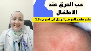 علاج حبوب الحرارة عند الأطفال | حب العرق عند الأطفال ( علاج طفح الحر ) فى المنزل