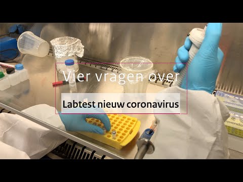 Vier vragen: laboratoriumtest nieuw coronavirus