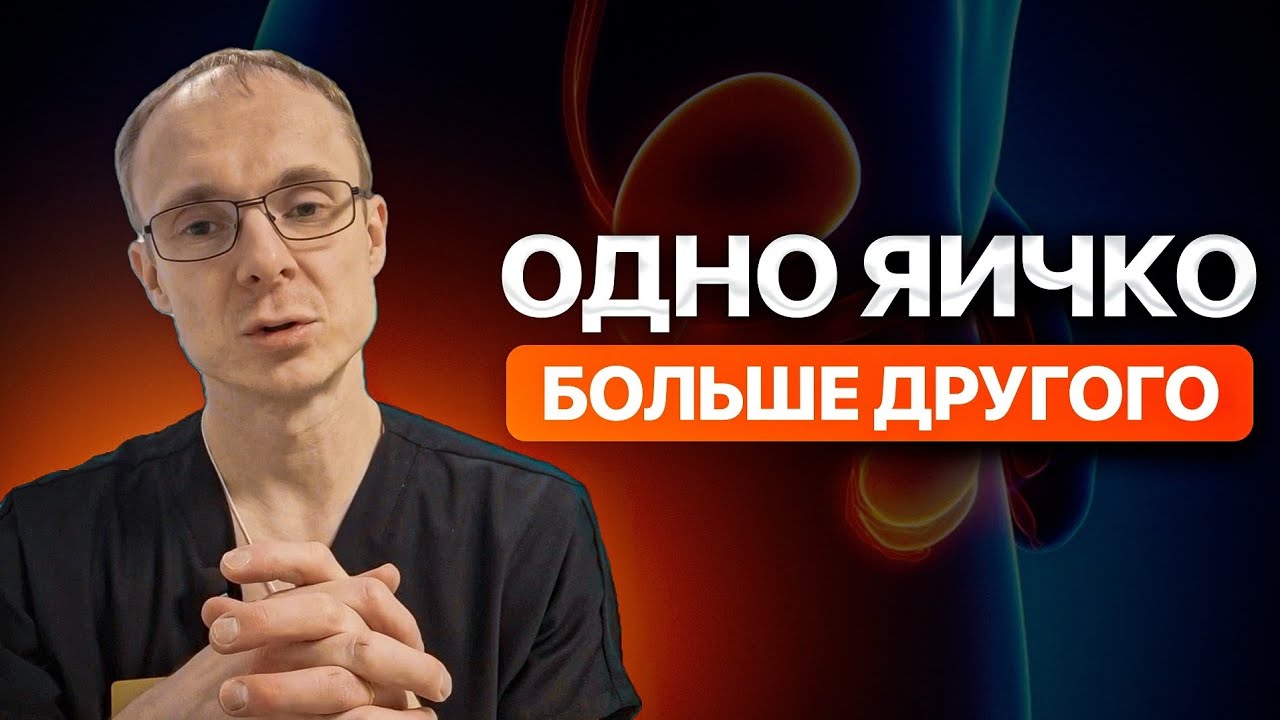 Одно яичко больше другого. Врач уролог-андролог. Москва.