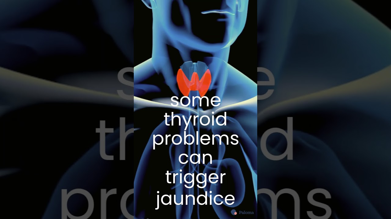 Yellow Skin & Eyes, Jaundice, & Your Thyroid  