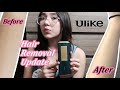 At-Home Ulike Painless &amp; Permanent Laser Hair Removal - Does It Work?