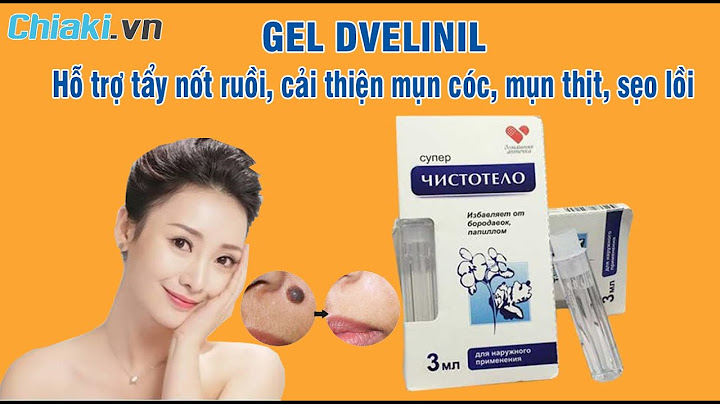 Review gel tẩy nốt ruồi nga