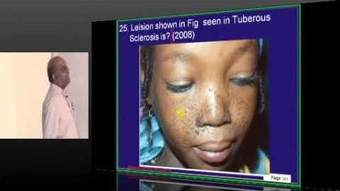 NEETPG Coaching Image Based MCQ