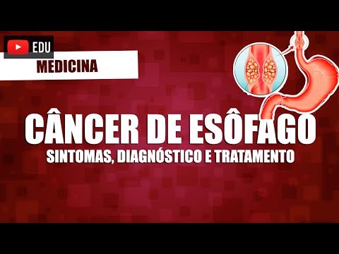 Vídeo: Câncer De Esôfago: Visão Geral, Causas E Sintomas