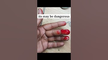 surgical blade change😥😥 with  safety😎😎