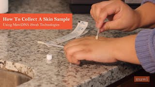 Collect Skin Samples with the iSWAB Microbiome Collection Kit | MawiDNA Technologies