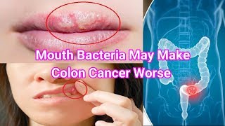 Study: Mouth Bacteria May Make Colon Cancer Worse.