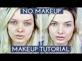 Acne coverage  no makeup makeup tutorial  mypaleskin
