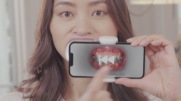 How to scan with your ScanBox Pro - Braces - CN