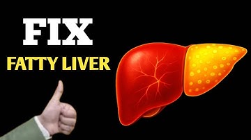 Do You Have a Fatty Liver?signs you shouldn