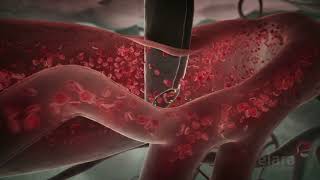 Malaria 3D Animation Shows How the Infection Spreads in the Body screenshot 4