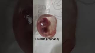 8 weeks pregnancy l 8 weeks fetus l Dr Nikhat Ansari l lear with Dr Nikhat