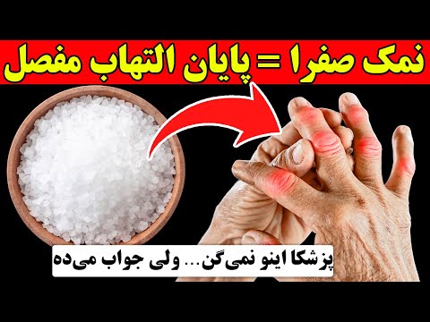 راز درمان آرتروز و نقرس با نمک های صفراوی نتیجه اش باورت نمی شه