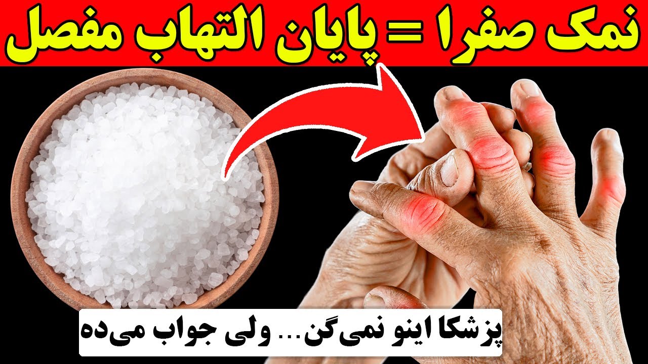 راز درمان آرتروز و نقرس با نمک‌های صفراوی! نتیجه‌اش باورت نمی‌شه