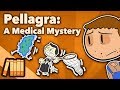Pellagra - A Medical Mystery - Extra History