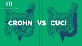 Crohn vs CUCI - ENARM