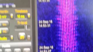 Sdrplay noaa 19 apt