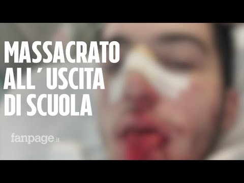 Emanuele pestato a sangue all'uscita di scuola: "Che gusto c'è a rovinare la vita delle persone?" Episode cover