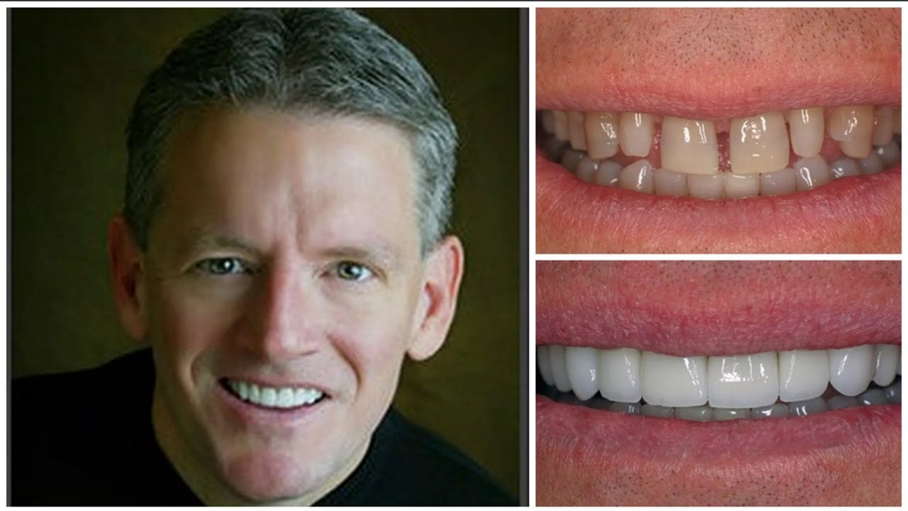 Фотопротокол В Стоматологии — Name-scan.ru