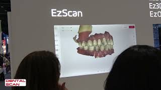 Una Vista al Escaner Intraoral EzScan de VATECH