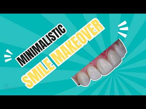 Minimalistic smile makeover