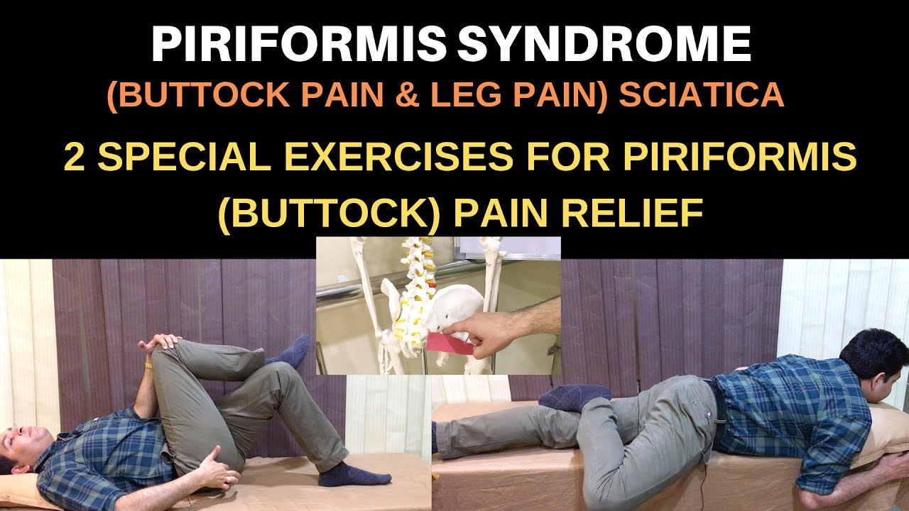 Piriformis Syndrome - South Vancouver Physiotherapy Clinic