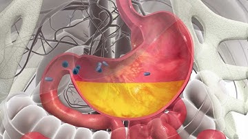 Clostridium difficile and fecal bacteriotherapy