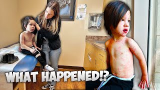 TODDLER GETS EXTREME RASH... RUSHED TO DOCTOR