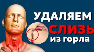 ВОТ САМЫЕ Эффективные способы избавления от слизи в горле в домашних условиях