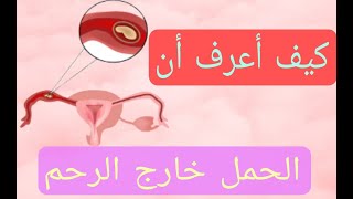 الحمل خارج الرحم || الحمل الهاجر
