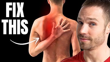 Fix Scapular Winging FAST (3 Simple Steps!)