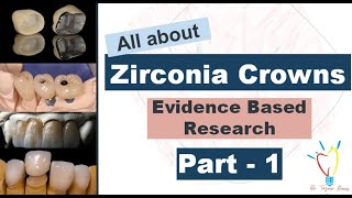 All about ZIRCONIA CROWNS - (Types/Phase transformation/Transformation Toughening/Prep Guidelines)