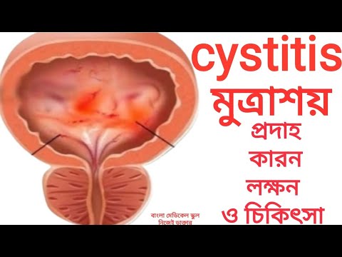 cystitis. মুত্রাশয়ের প্রদাহ।মুত্রাশয়ের প্রদাহের কারন লক্ষন চিকিৎসা ঔষধ ও পরামর্শ