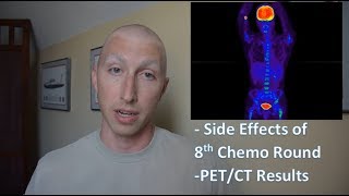 18.  Chemo 8 and PET/CT Results