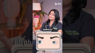 Botox for eye twitch | Eye twitching problem #shorts #eyes