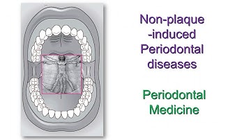 BSP WEBINAR - Non-plaque induced Periodontal diseases by Prof. Iain Chapple