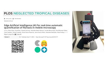 Real-time automatic quantification of filariasis with HuggingSpot