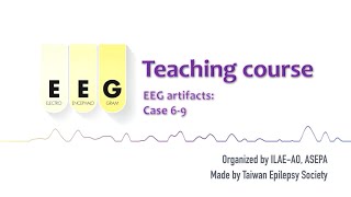 EEG artifacts - Case 6-9: #14 ILAE-AO & ASEPA EEG teaching course
