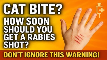 What To Do If a Cat Bites You — Rabies Vaccine Timing Explained