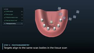 Stacking the Digital Layers: How a Full-Arch Implant Case Comes Together in CAD | Animation