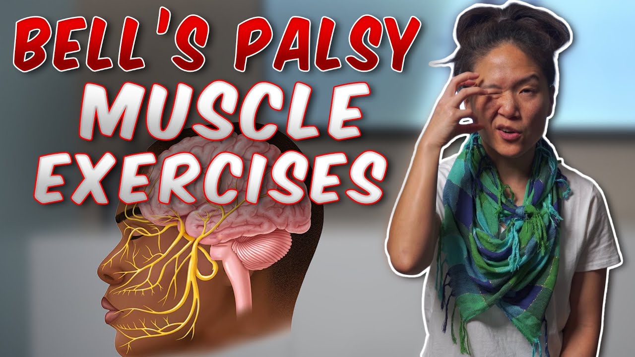 Bell's Palsy Exercises to Improve Muscle Control | Physical Therapist