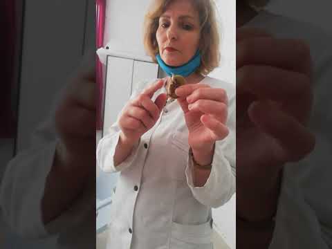 التكاثر بالبذور مكونات البذرة