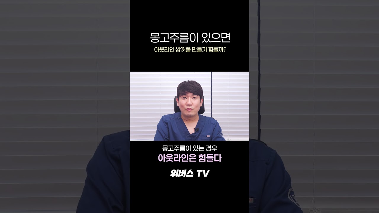 [Вэбэрс гоо сайхны мэс заслын эмнэлэг] Монгол нугалаас байвал аутлайн давхар зовхи хийх хэцүү байдаг уу???