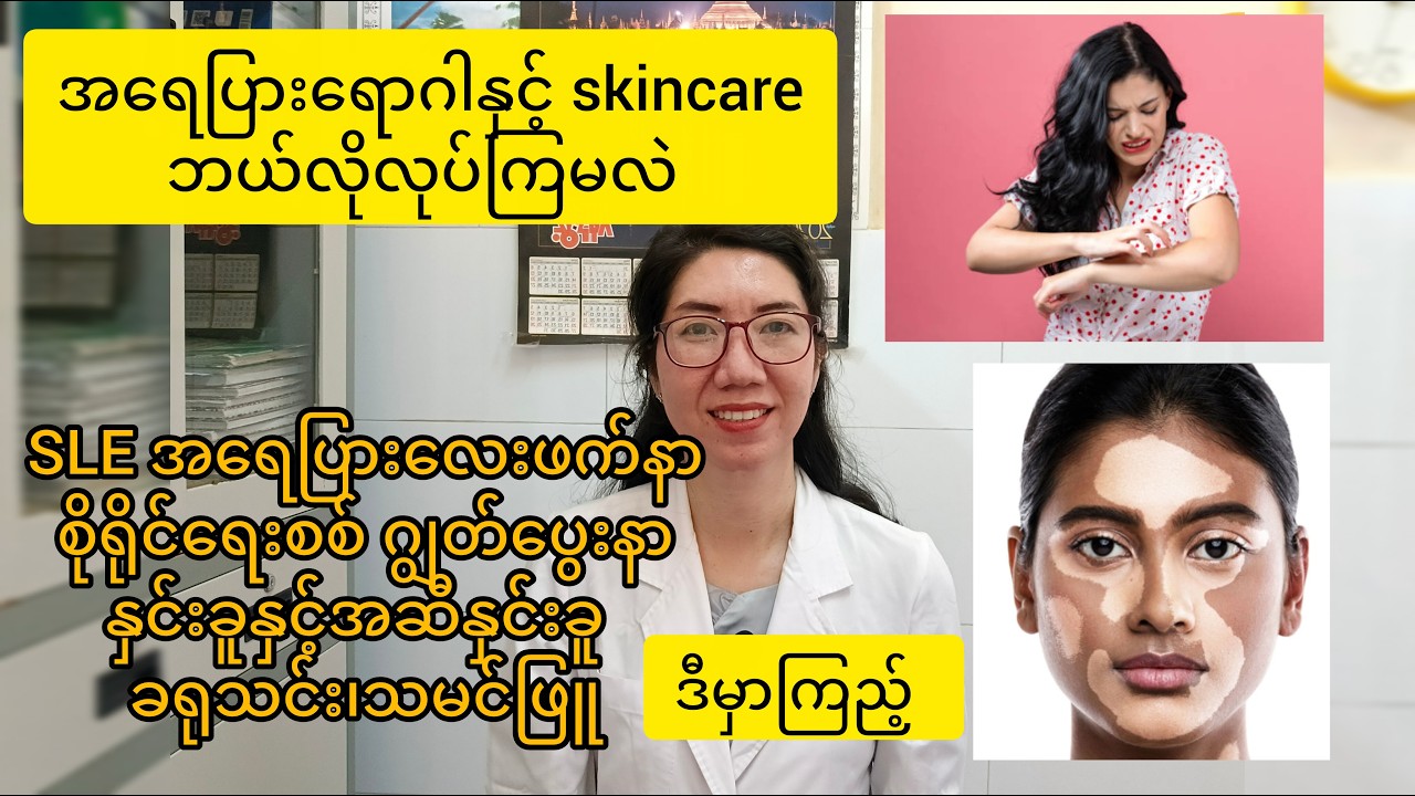 Skincare for skin diseases အရေပြားရောဂါတွေလည်းဆေးကုတာပိုထိရာက်ဖို့ skincareလိုအပ်ပါတယ်